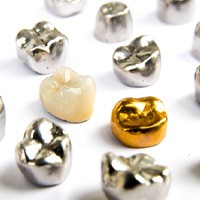 Variety of dental crowns